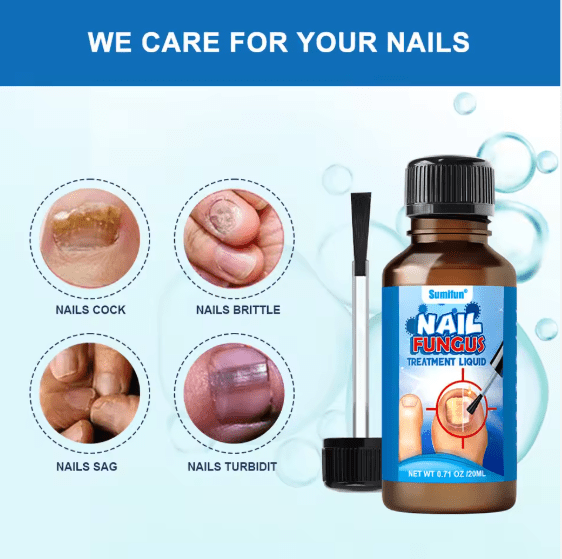 Sumifun Nail Fungus Treatment Liquid – Antifungal Nail Repair Solution 20ml