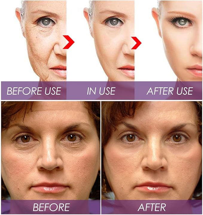 Venature Bakuchiol Retinol Rejuvenation Serum – Anti-Aging Facial Serum 30ml