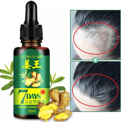 7 Days spray Hair Growth Germinal Serum Oil Natural Hair Treatment Effective Fast Growth Hair Care 30ML