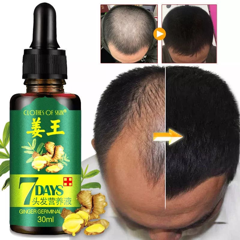 7 Days spray Hair Growth Germinal Serum Oil Natural Hair Treatment Effective Fast Growth Hair Care 30ML