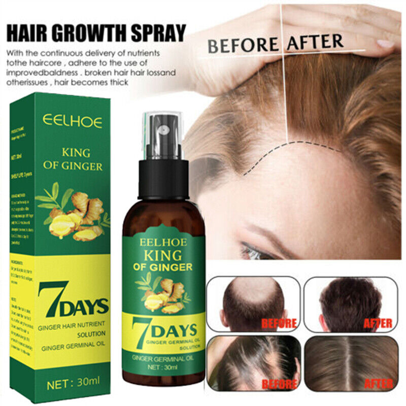 7 Days spray Hair Growth Germinal Serum Oil Natural Hair Treatment Effective Fast Growth Hair Care 30ML
