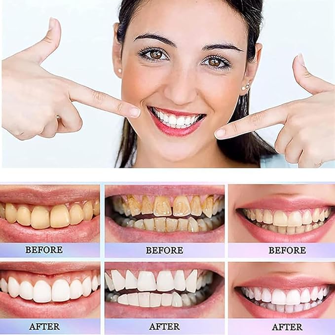 Oralhoe Nicotinamide Dazzle White Toothpaste – Vitamin B3 Whitening Gel 100g