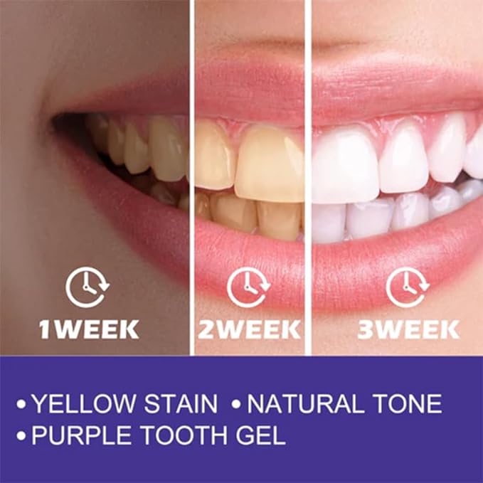 Purple Whitening Toothpaste – Colour Corrector for Instantly Brighter Teeth