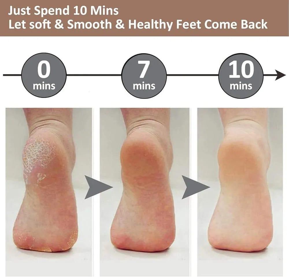 💡 Rechargeable Electric Pedicure Foot dead skin removal