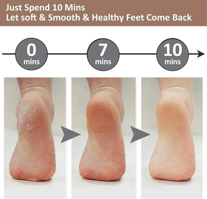 💡 Rechargeable Electric Pedicure Foot dead skin removal