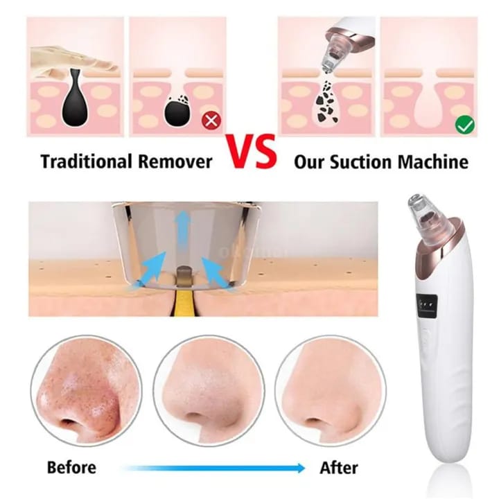 Electric Rechargeable Blackheads remover vacuum pore cleaner | Face Deep cleansing.